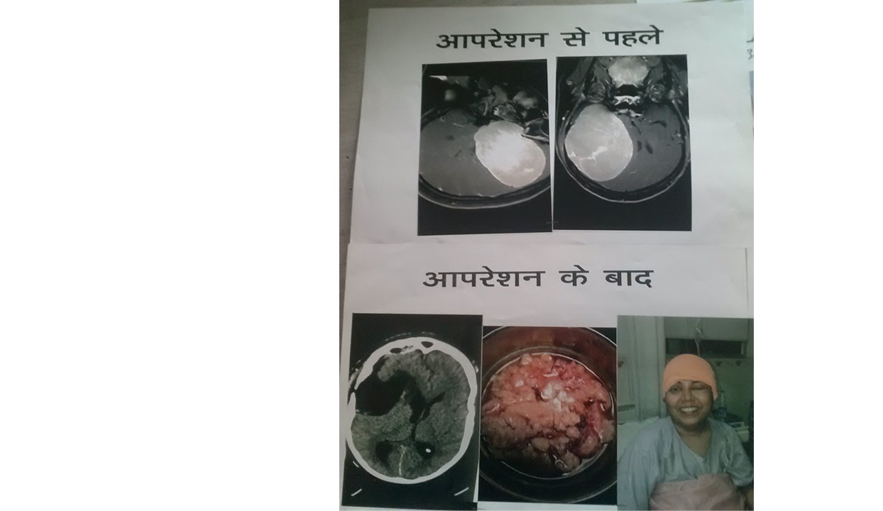 Pre-operative and Post-operative Patient